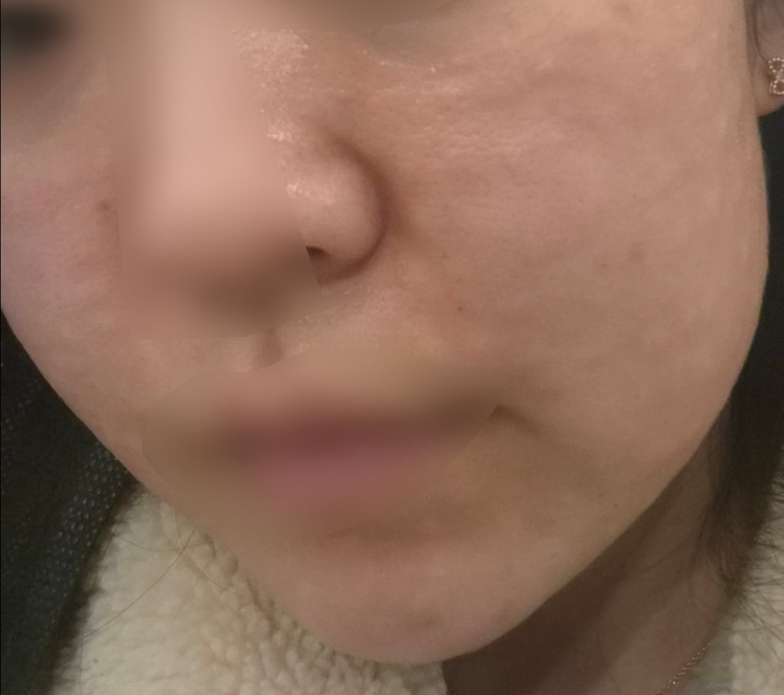 수술후기이미지