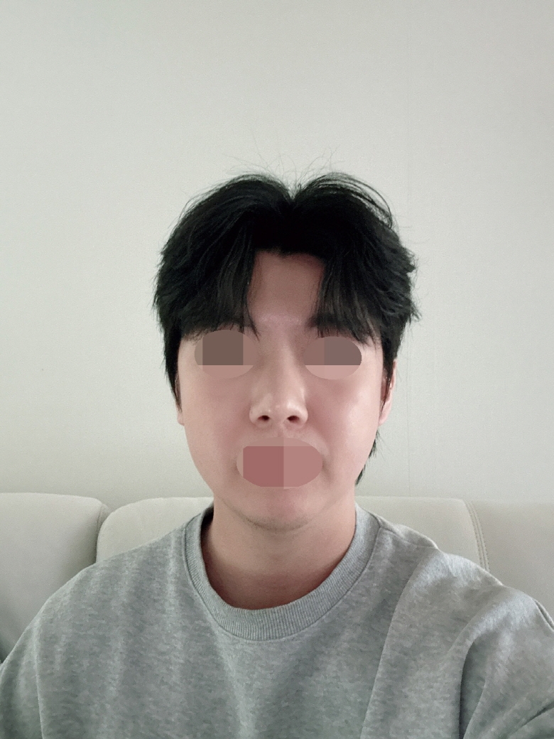 수술후기이미지