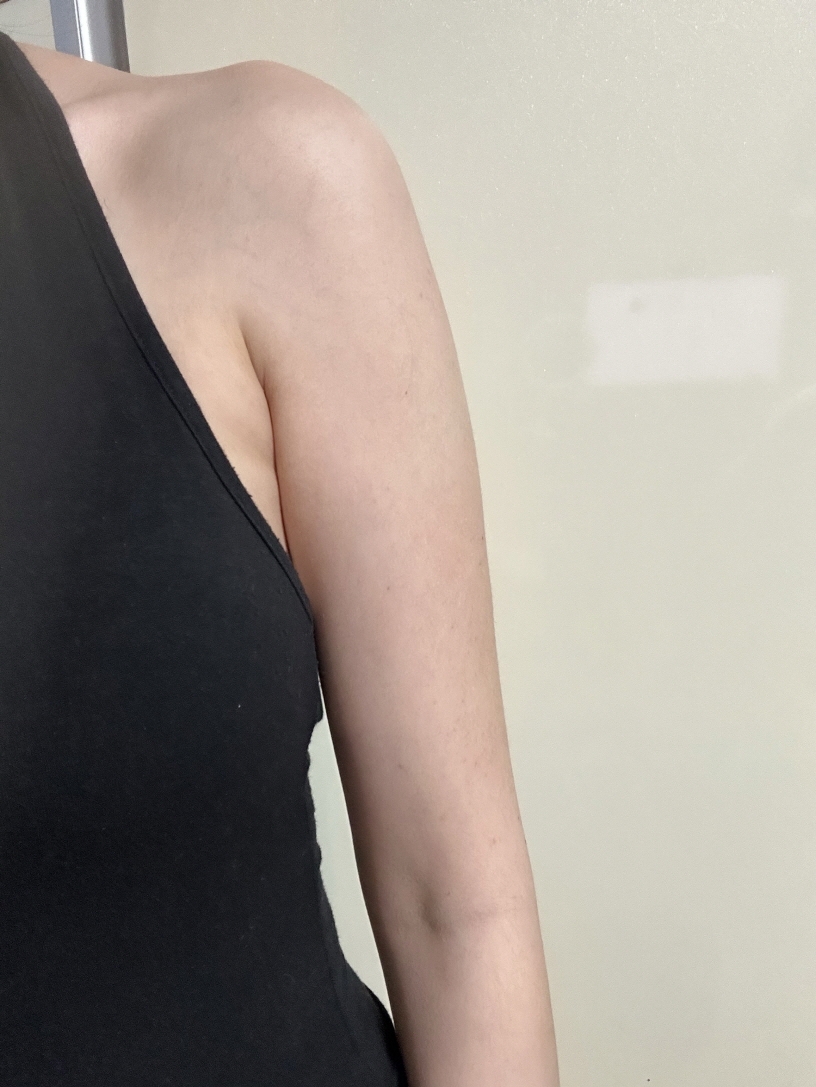 수술후기이미지