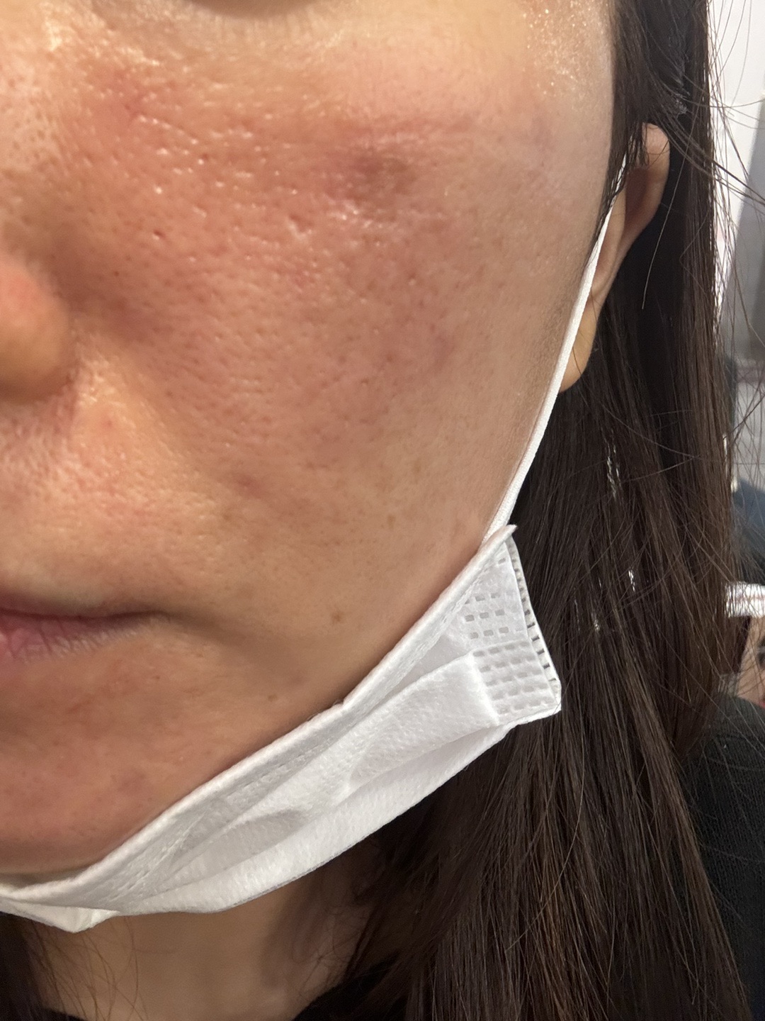 수술후기이미지