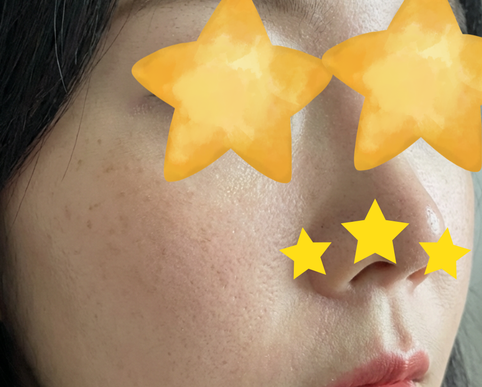 수술후기이미지