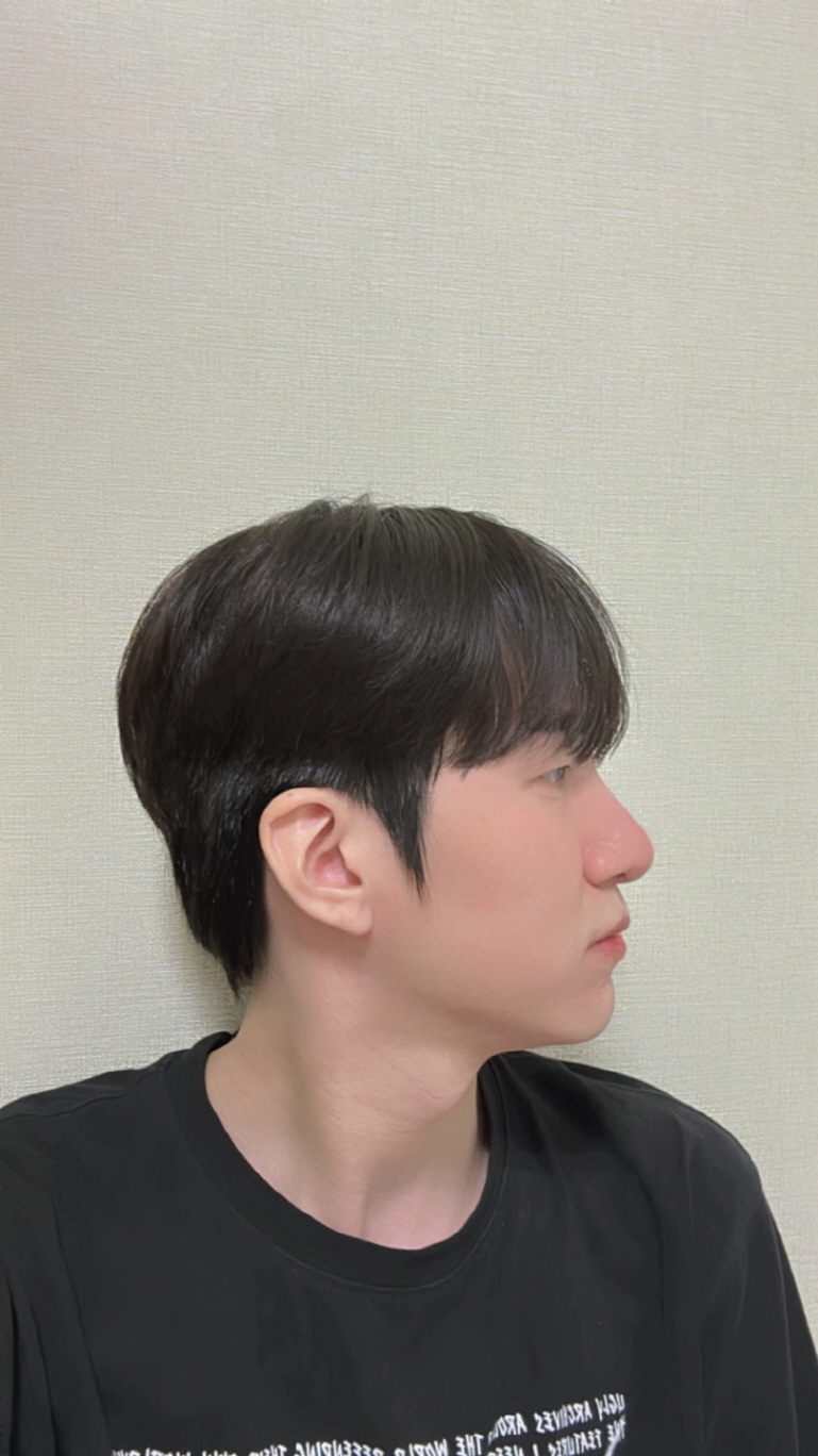 수술후기이미지