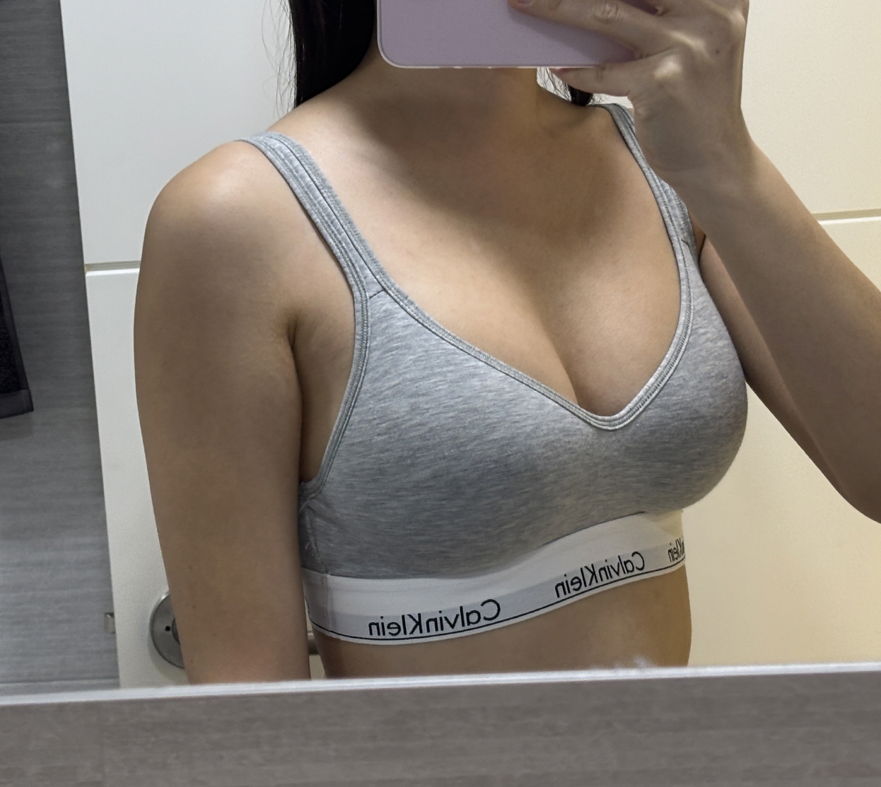 수술후기이미지