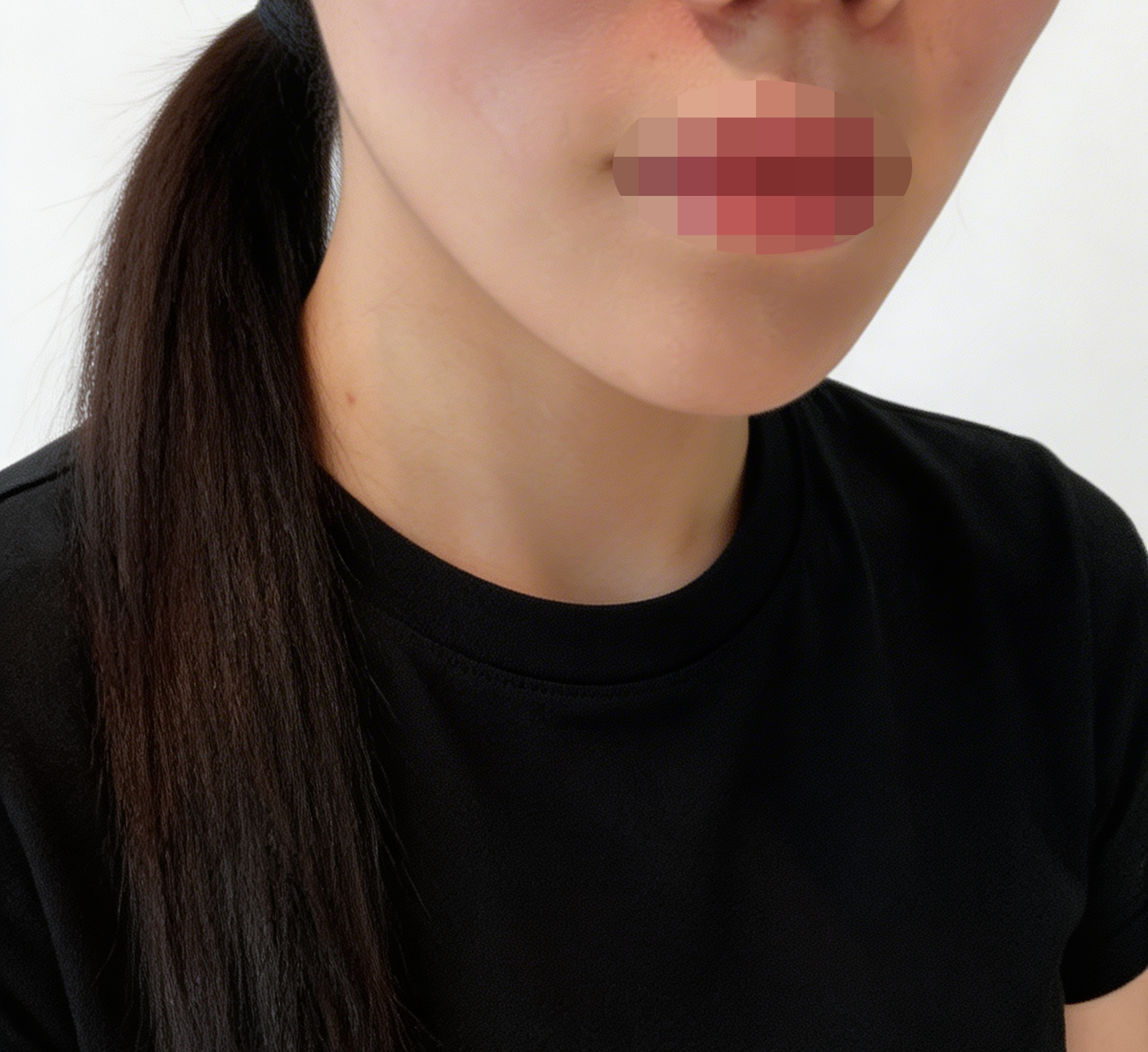 수술후기이미지