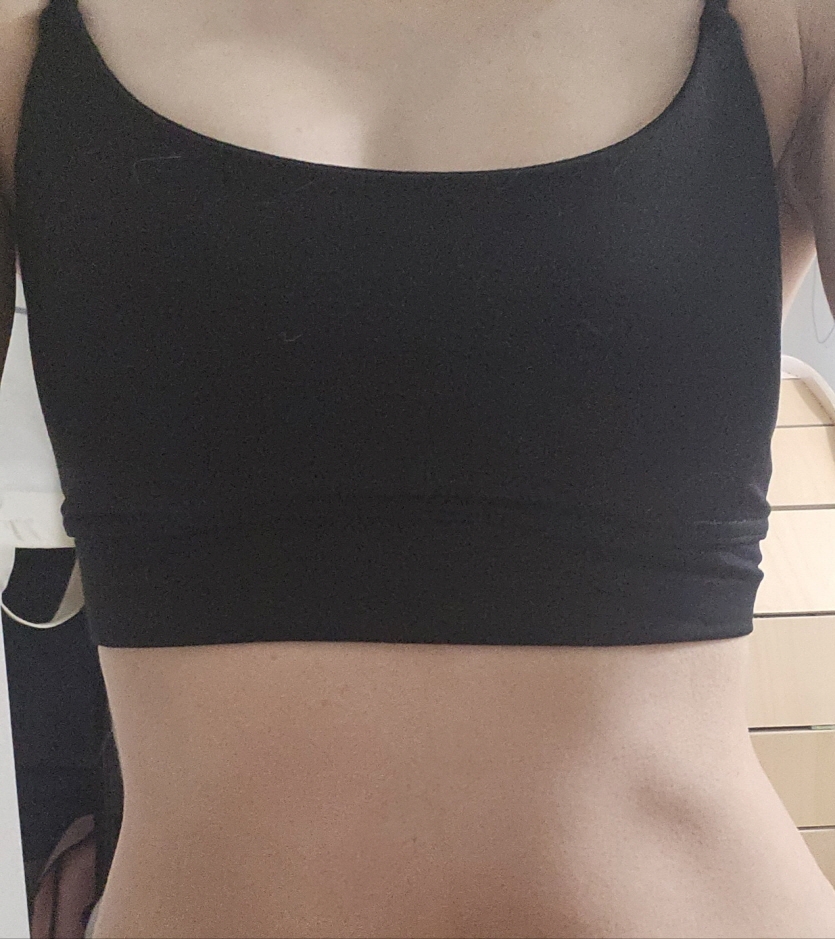 수술후기이미지