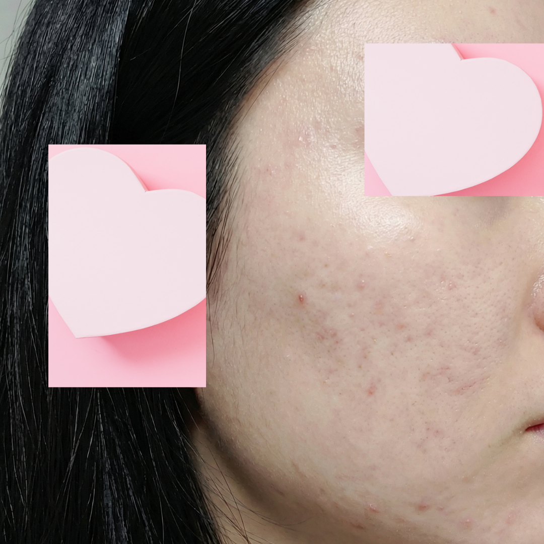 수술후기이미지