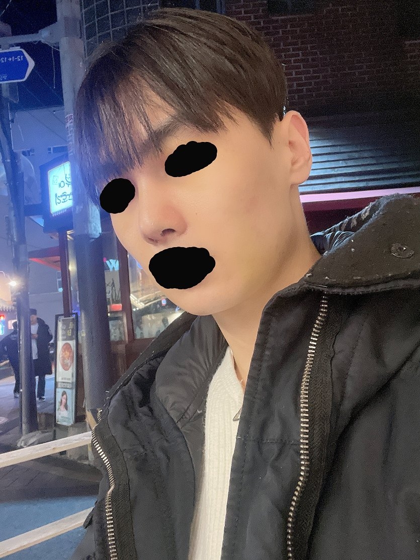 수술후기이미지