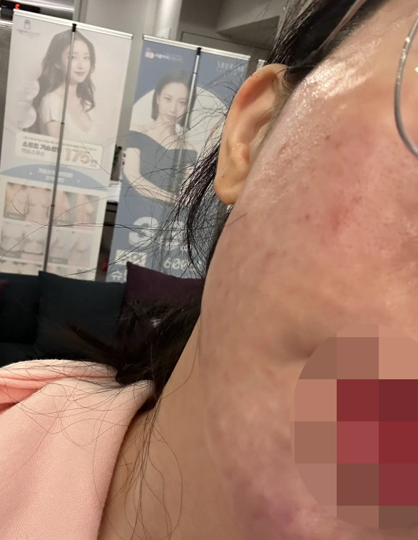 수술후기이미지