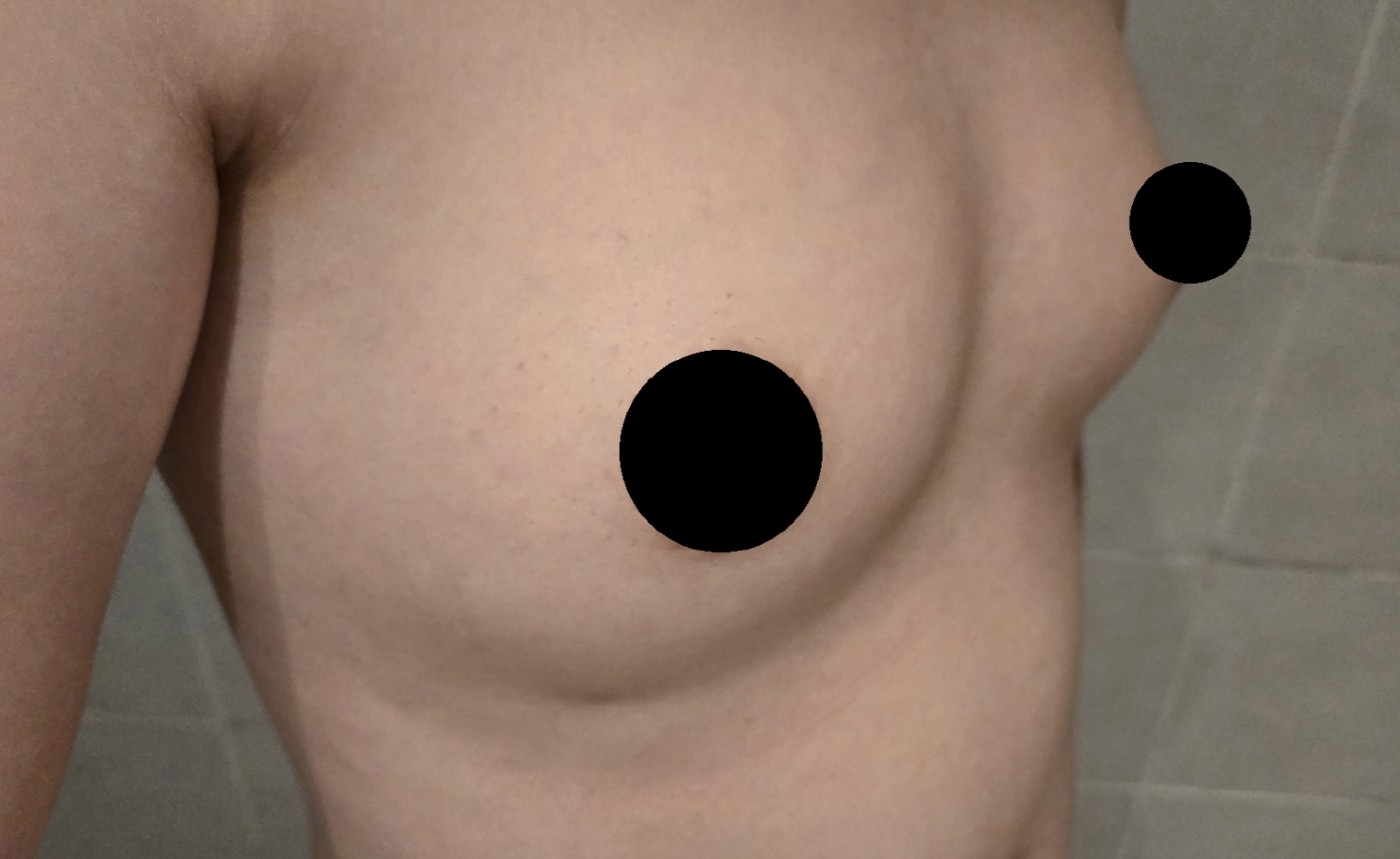 수술후기이미지