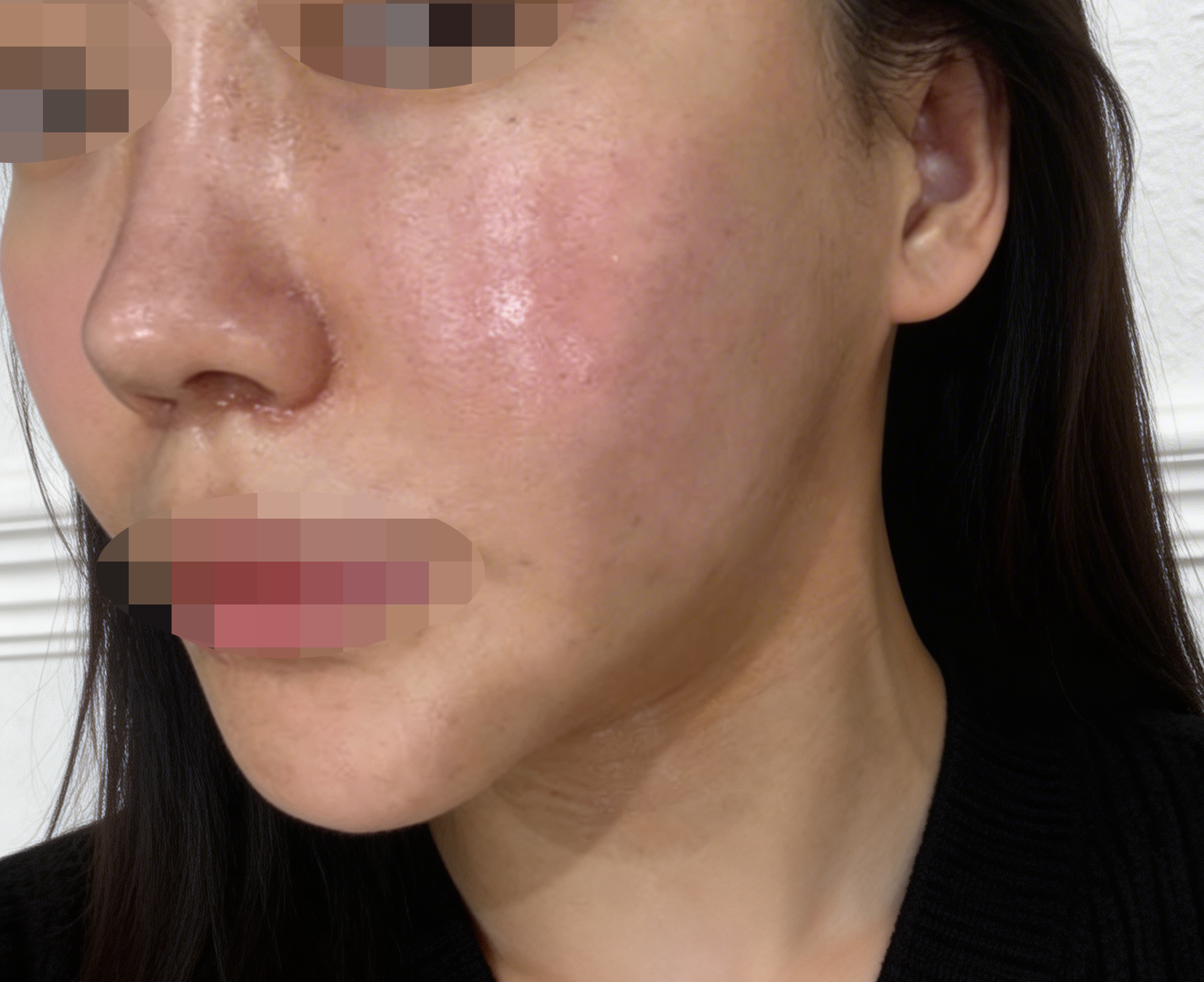 수술후기이미지