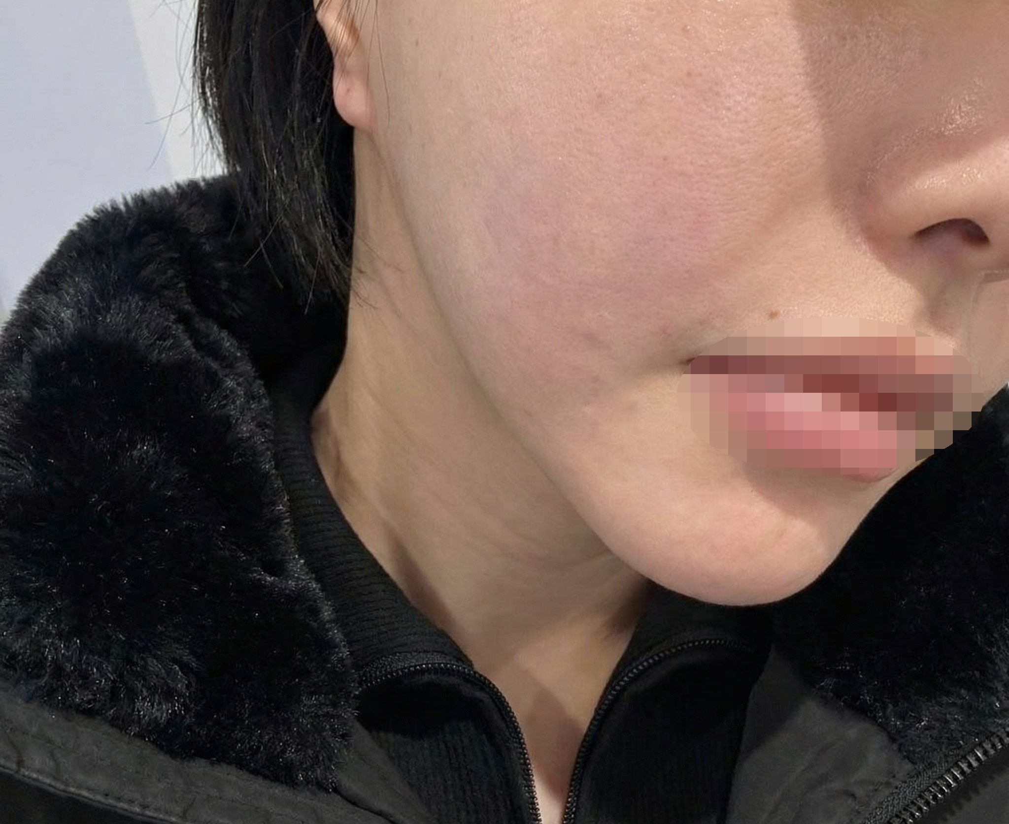 수술후기이미지