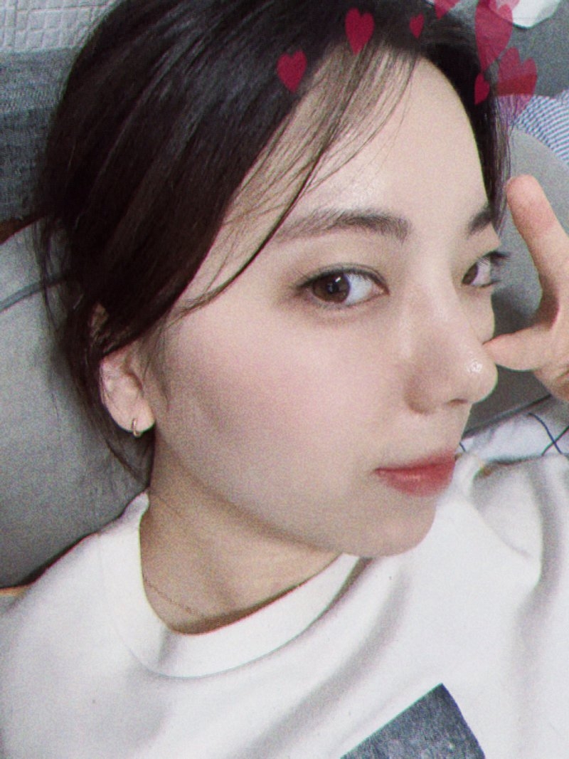 수술후기이미지