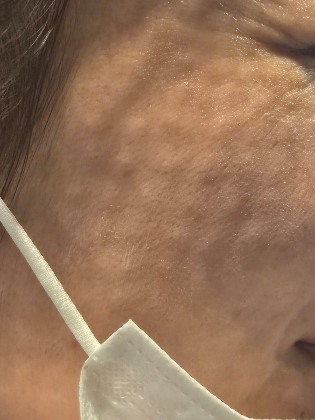 수술후기이미지