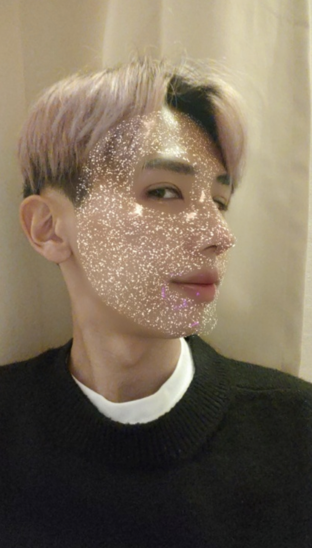 수술후기이미지