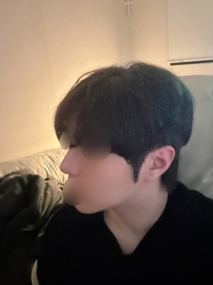 수술후기이미지