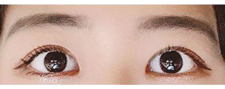 수술후기이미지