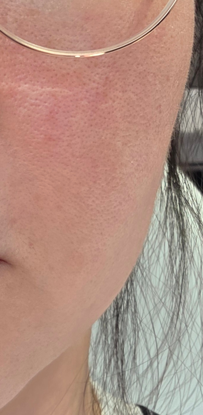 수술후기이미지