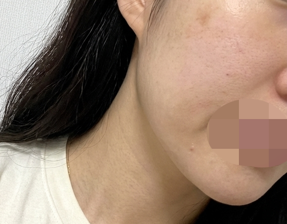 수술후기이미지