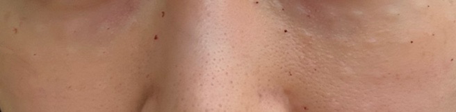 수술후기이미지