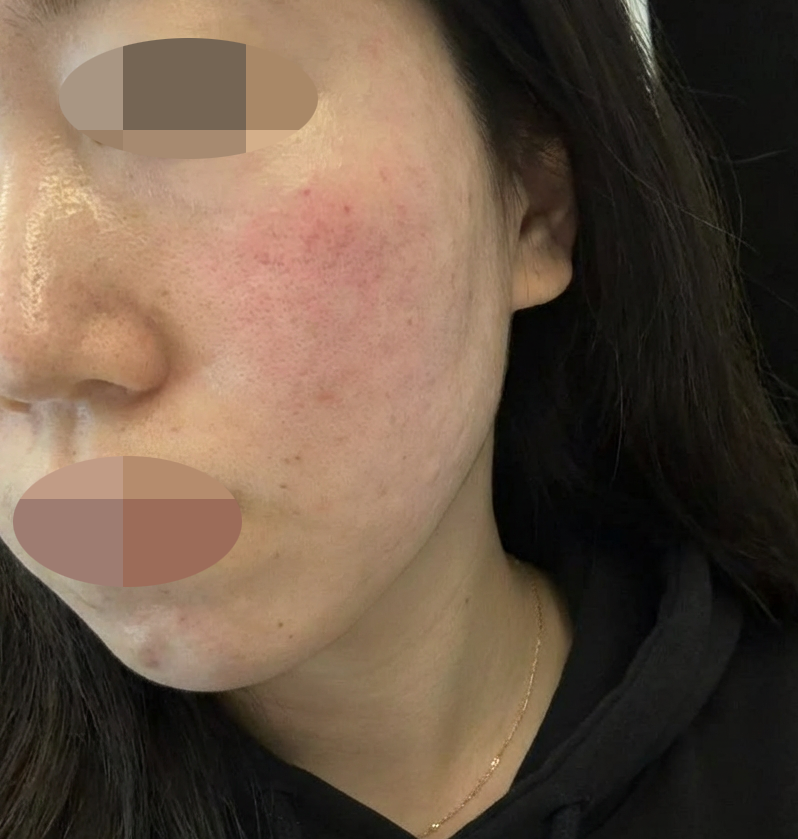 수술후기이미지