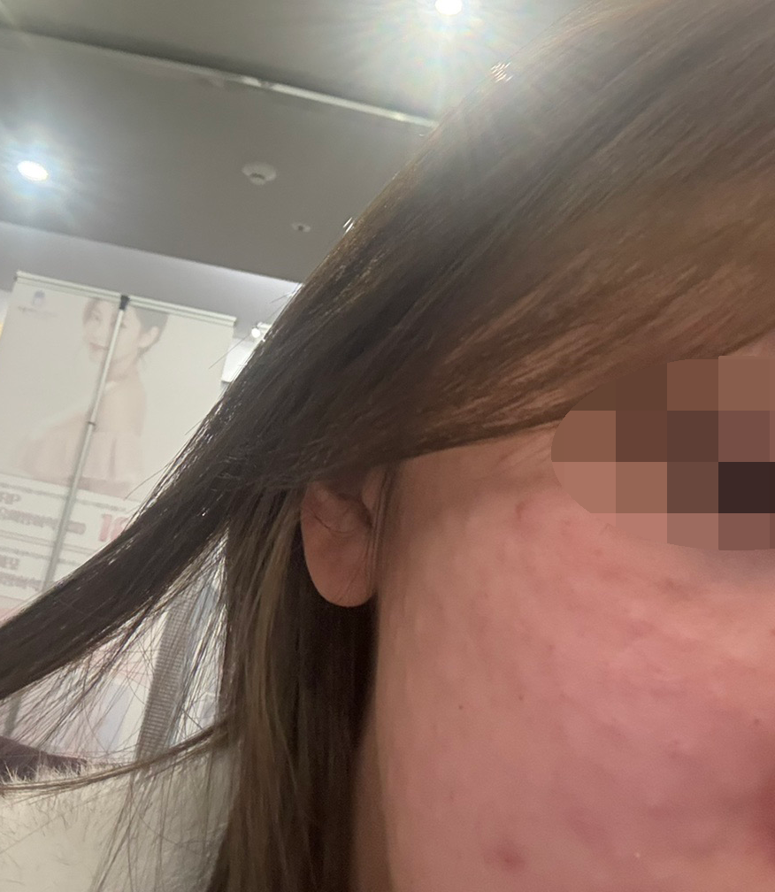 수술후기이미지