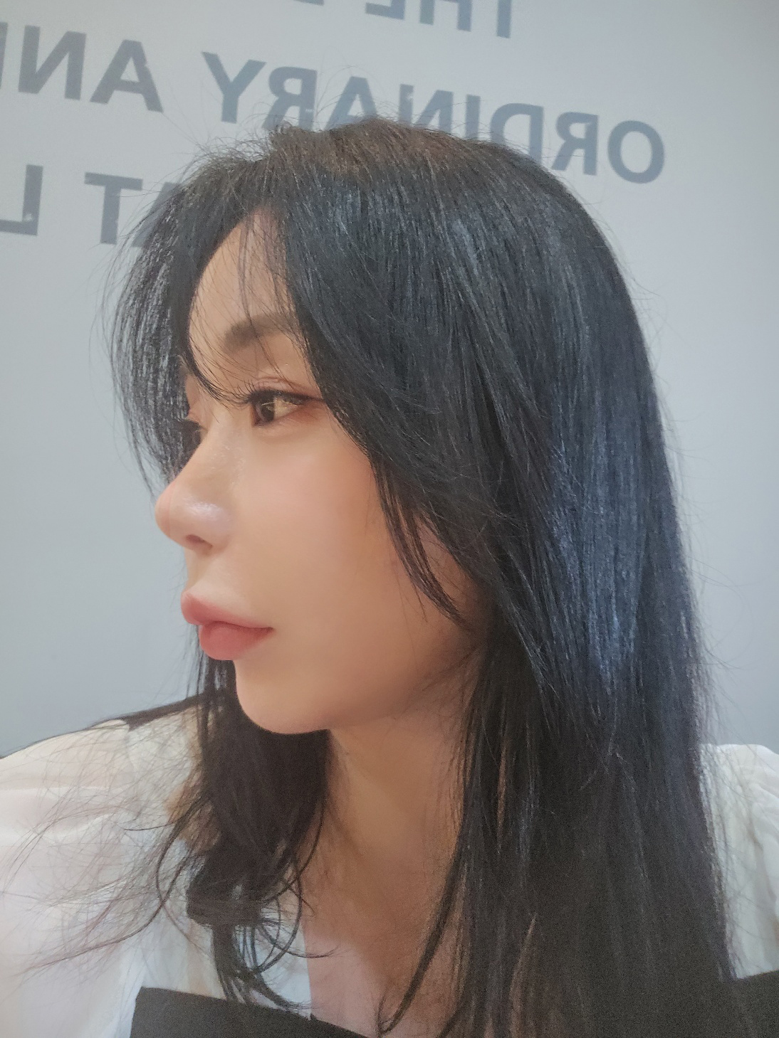 수술후기이미지