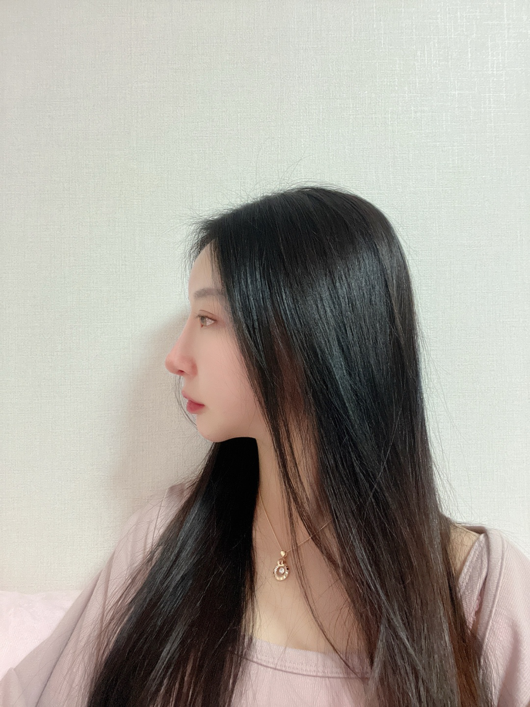 수술후기이미지