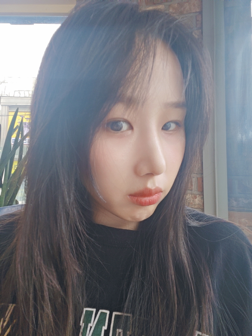 수술후기이미지