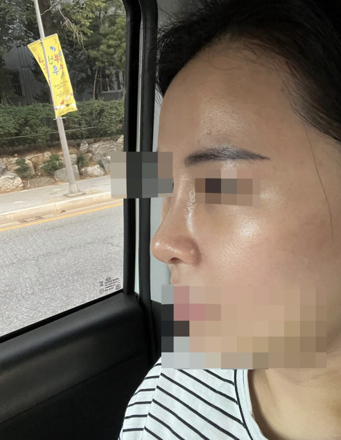 수술후기이미지