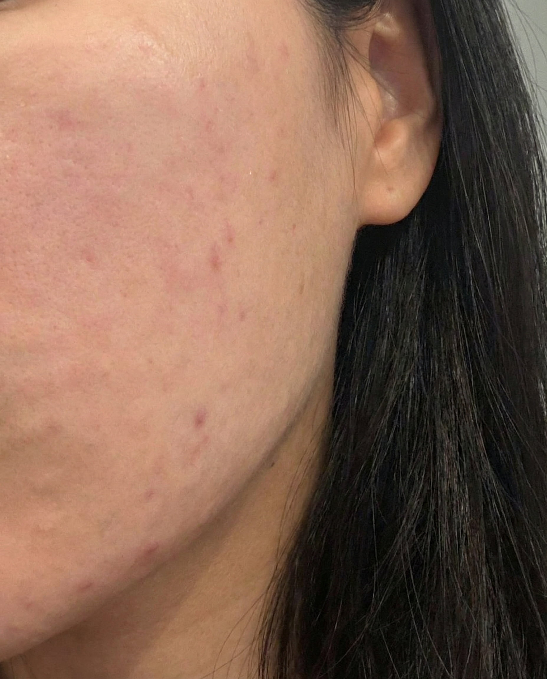 수술후기이미지