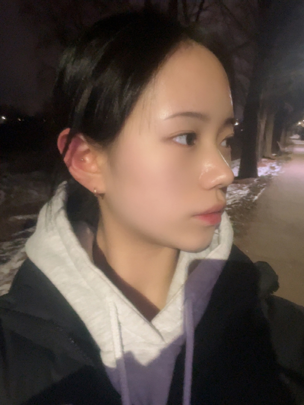 수술후기이미지