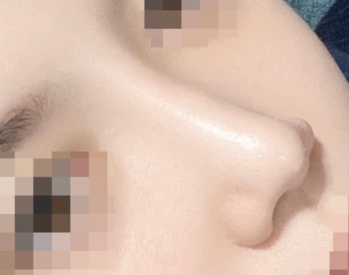 수술후기이미지