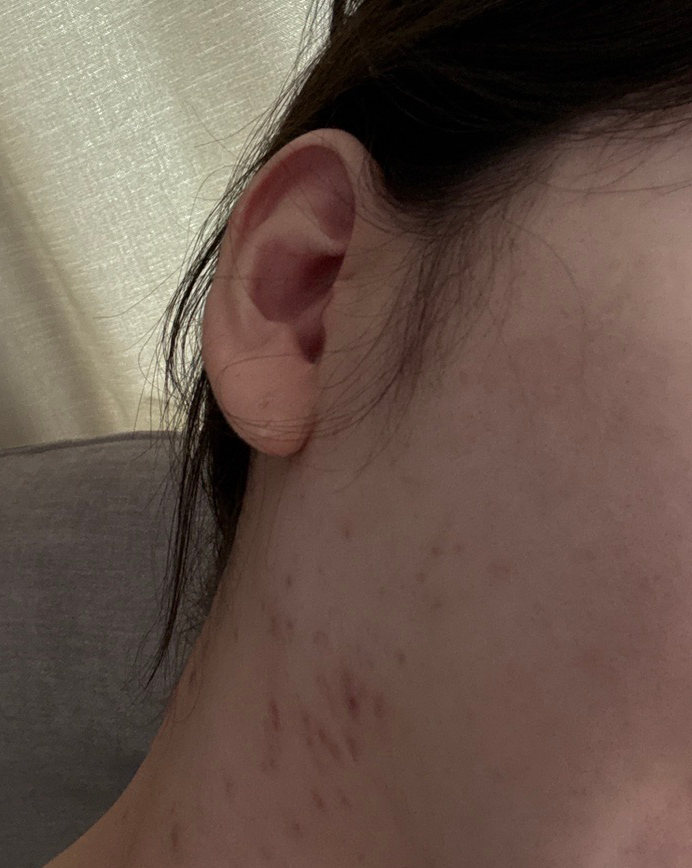 수술후기이미지