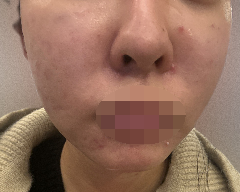 수술후기이미지