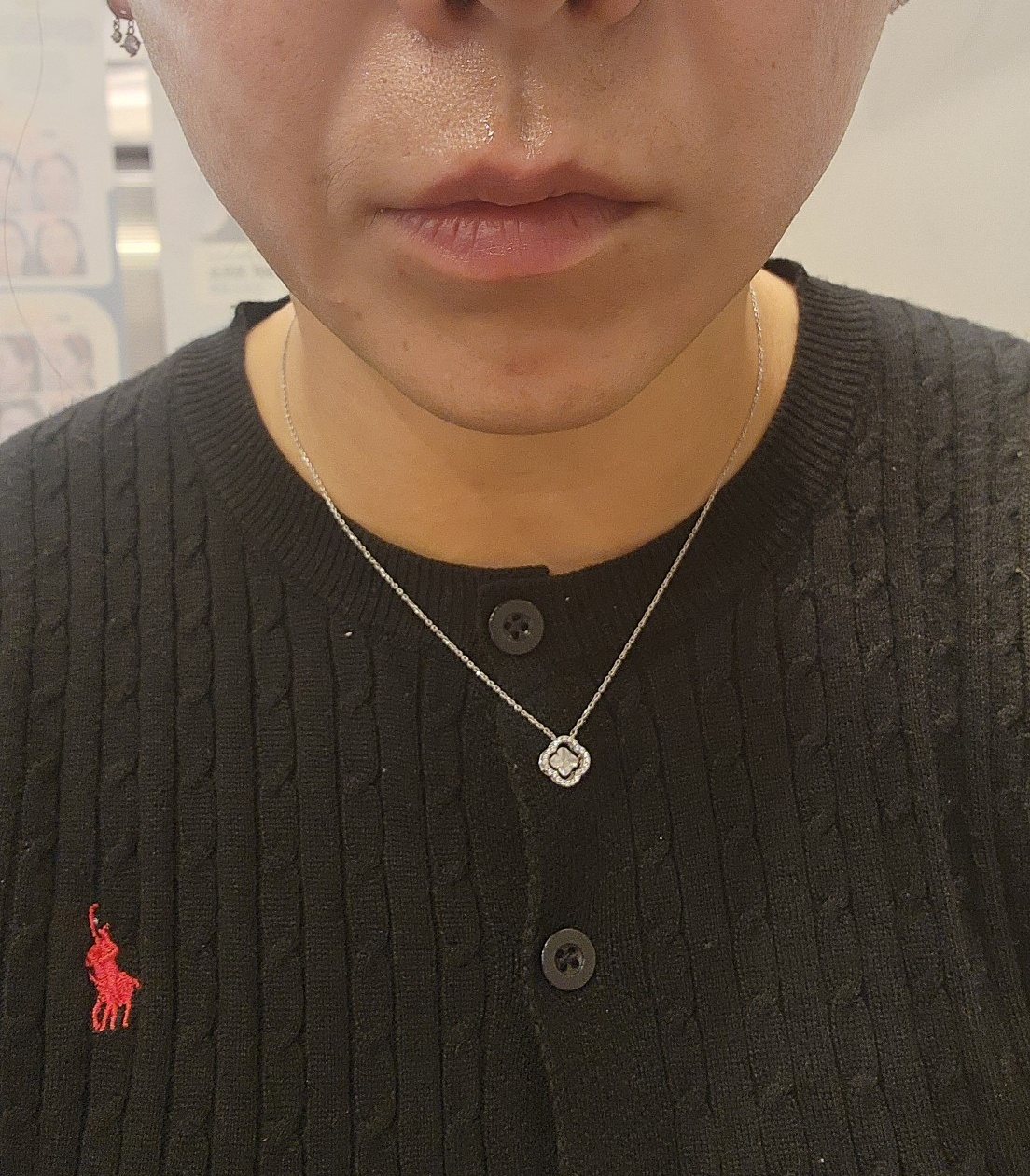 수술후기이미지