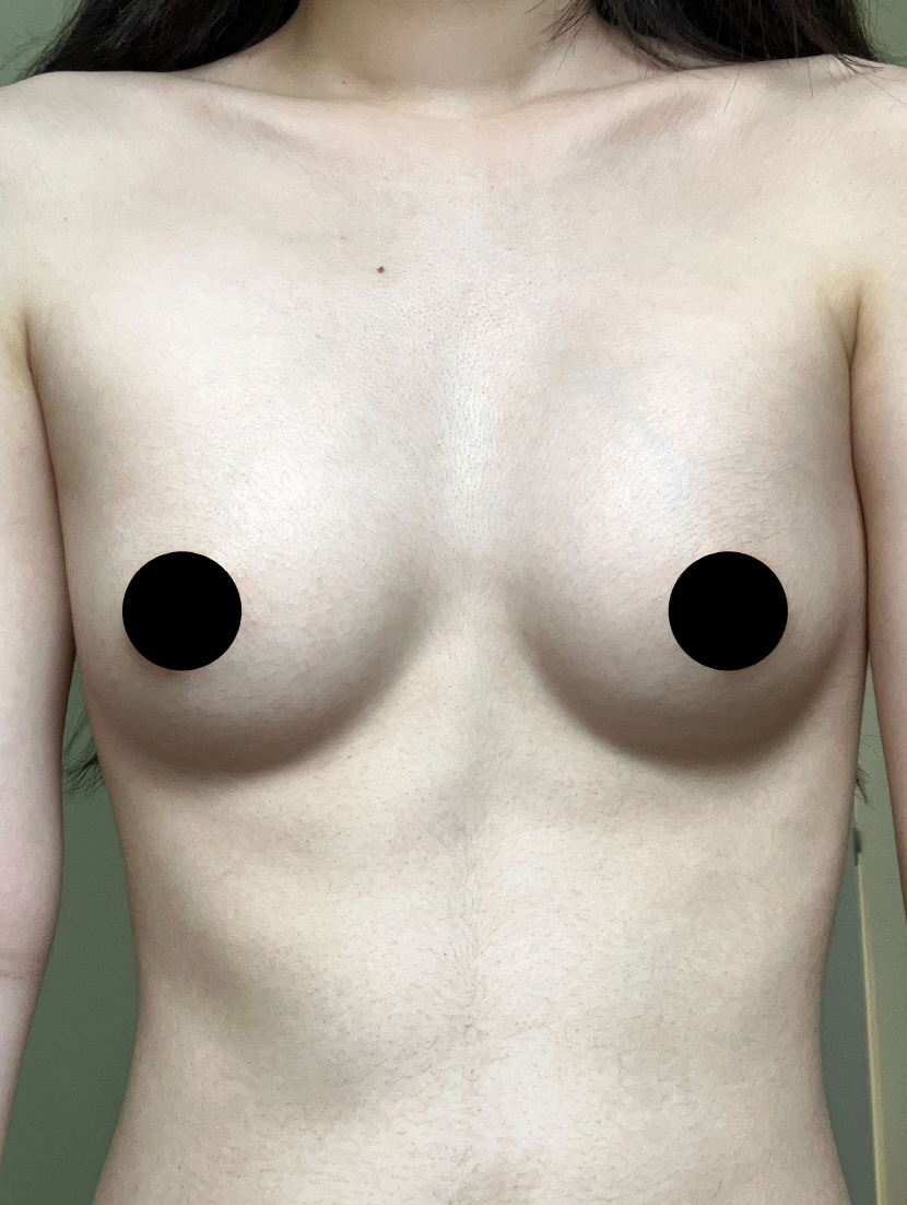 수술후기이미지