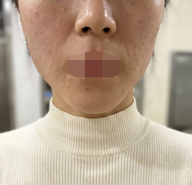 수술후기이미지