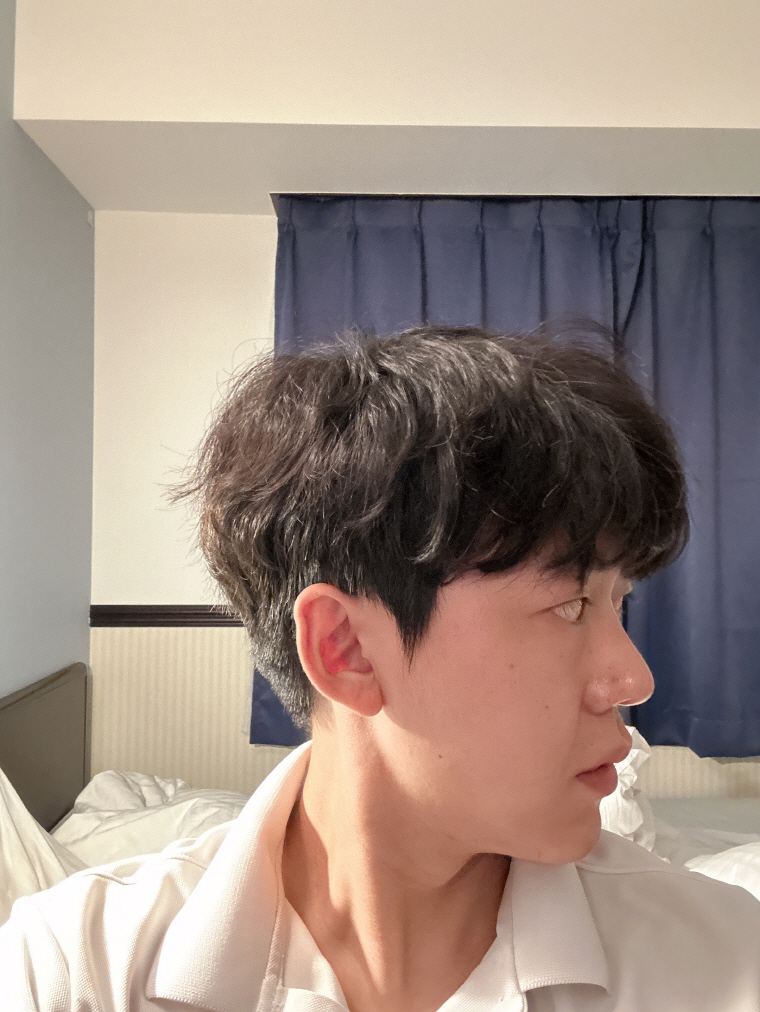 수술후기이미지