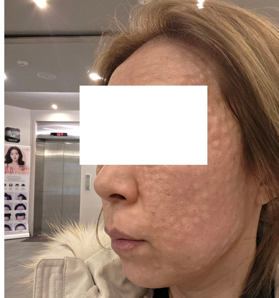 수술후기이미지