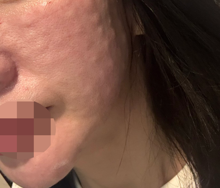 수술후기이미지