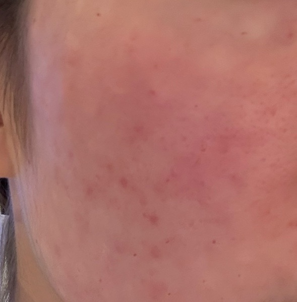 수술후기이미지