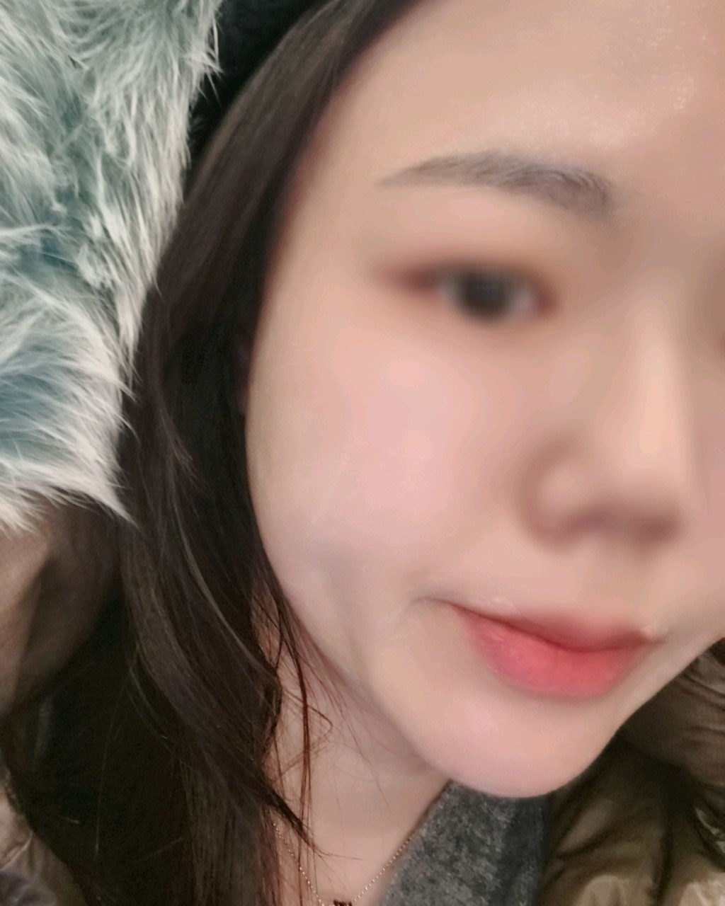 수술후기이미지