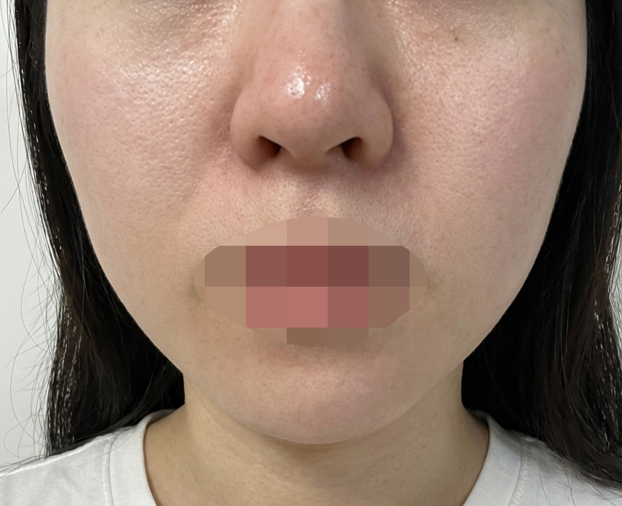 수술후기이미지