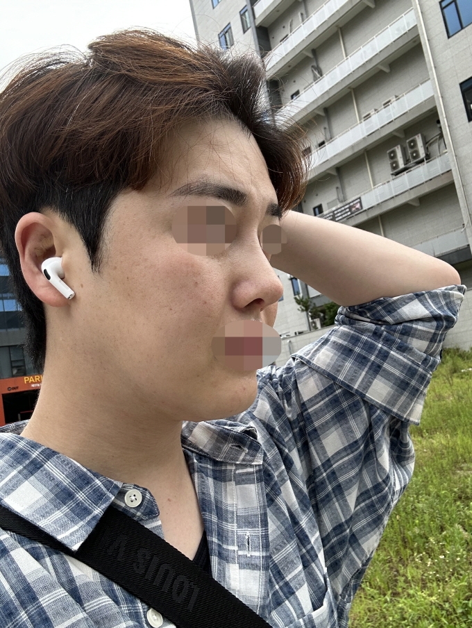 수술후기이미지