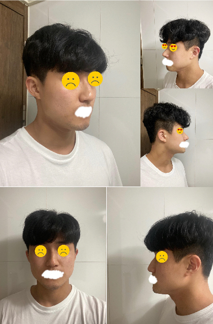 수술후기이미지