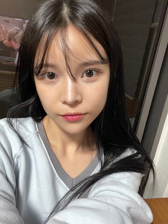 수술후기이미지