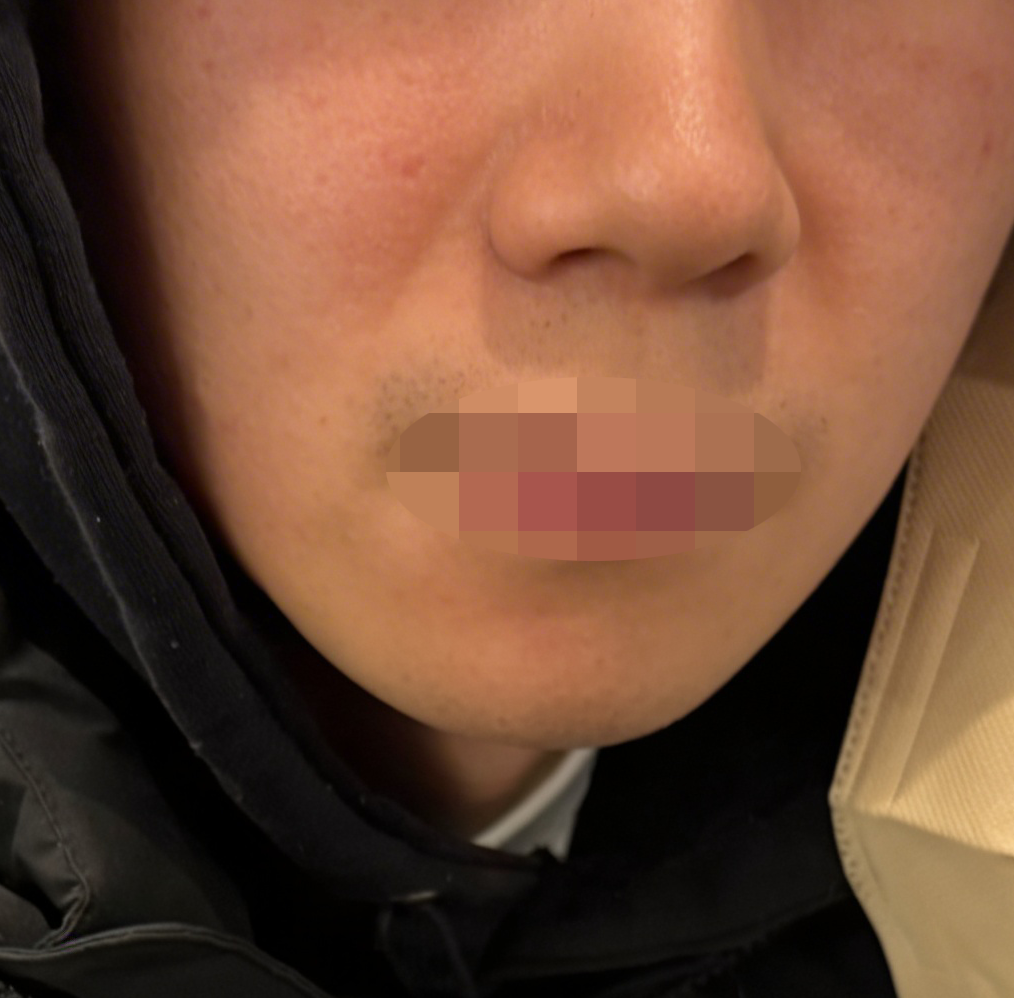 수술후기이미지