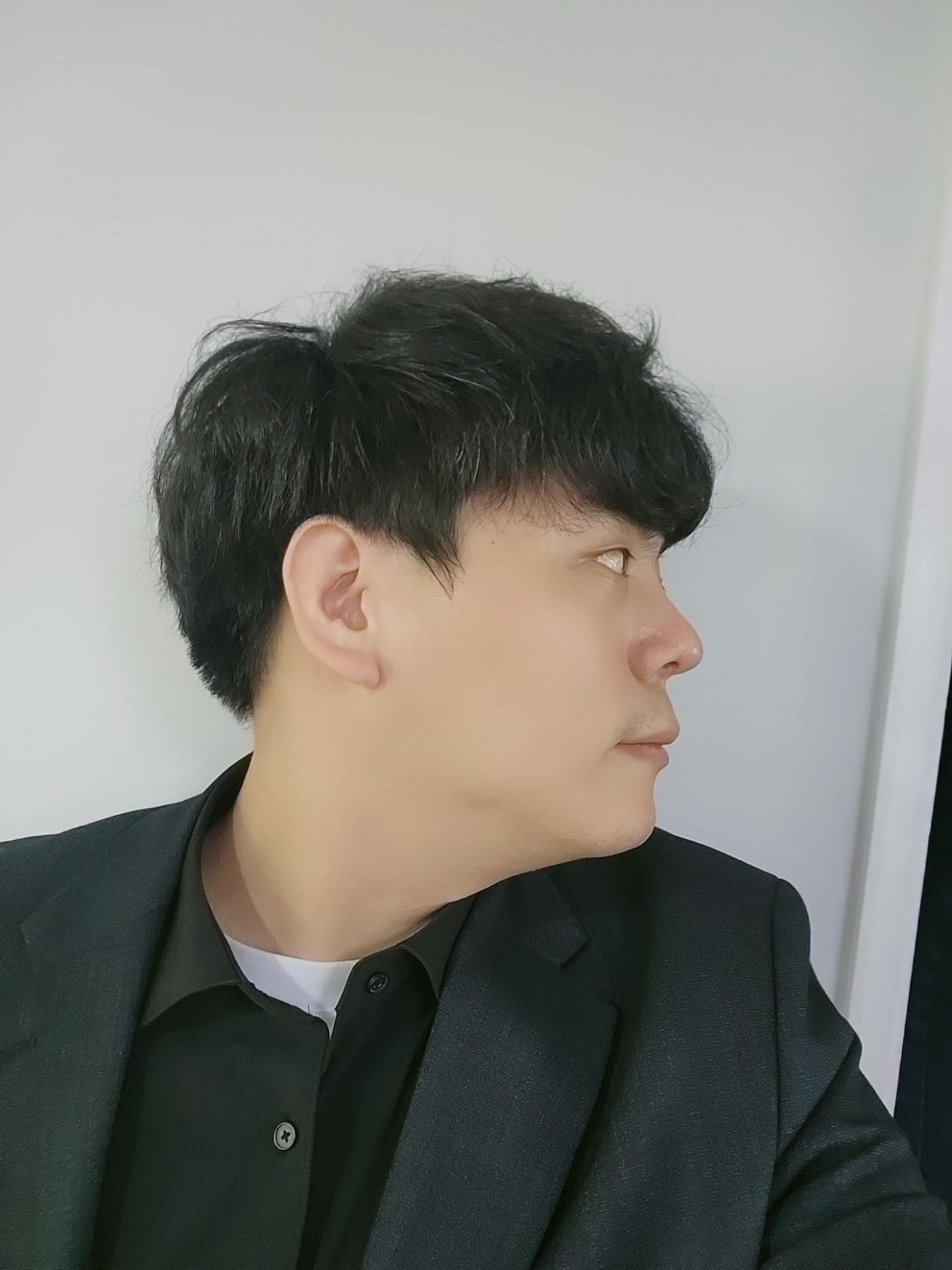 수술후기이미지