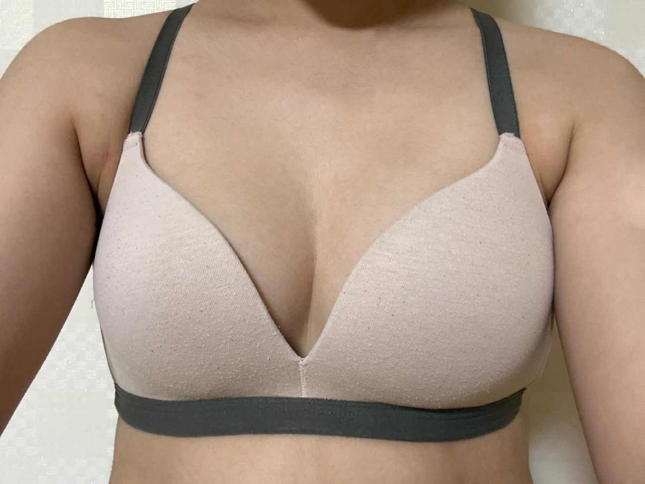 수술후기이미지