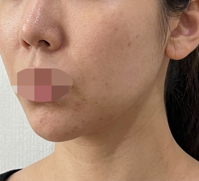 수술후기이미지